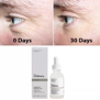 THE ORDINARY ARGIRELINE SOLUTION 10% (30ml)