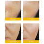MIRACLE MUSE STIBA A CREAM (30ml)