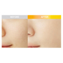 DR.G 3D VITAMIN C NIACINAMIDE 5% BOOSTER BRIGHTENING SERUM (30ml)